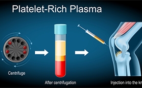 PRP vs. Cortisone: Which Is Better for Joint Pain and Inflammation?